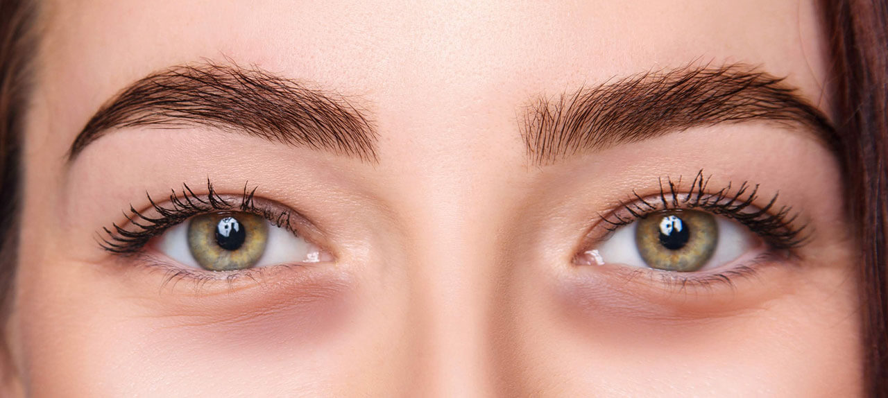 Terapia biorivitalizzazione zona perioculare per occhiaie